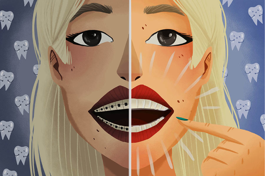 Cartoon girl with Invisalign on one side of smile and regular braces on the other.