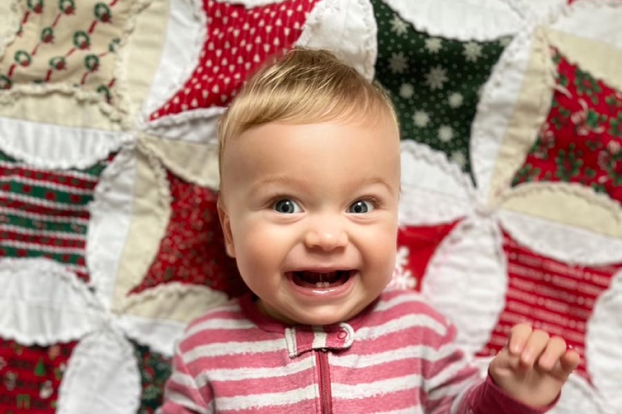 Photo of a smiling baby after he had a frenectomy.