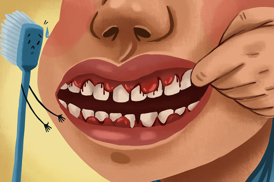 Cartoon of a patient with bleeding gums in need of laser gum therapy.
