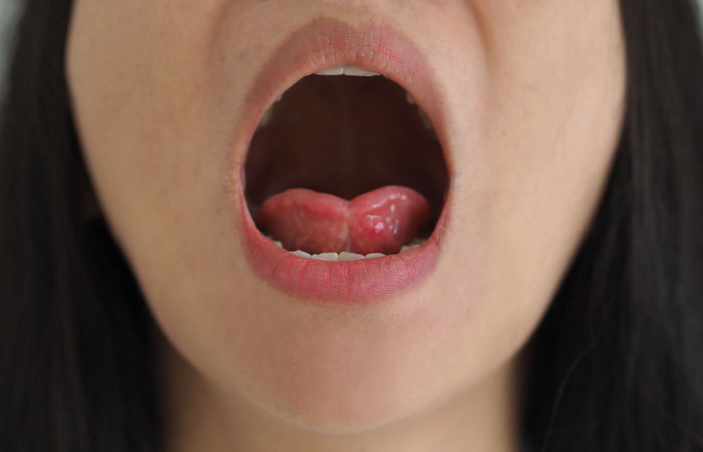 Woman with her mouth open and her tongue not able to be lifted up .