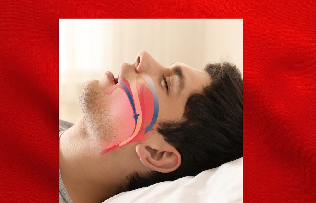 Red Flags for sleep disordered breathing show a red background with a photo of a man and what an obstructed airway looks like