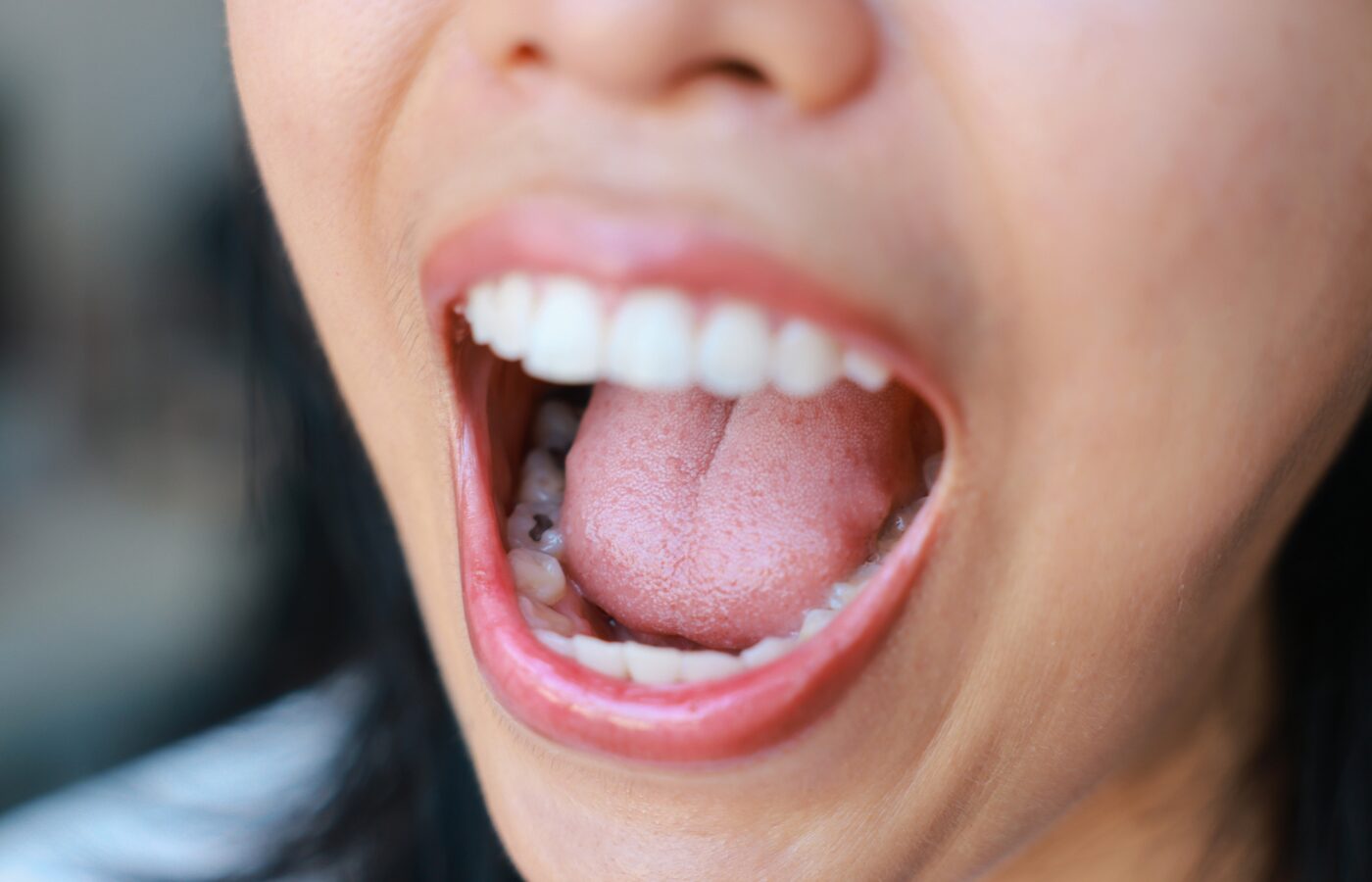 wpmen’s mouth open showing silver fillings